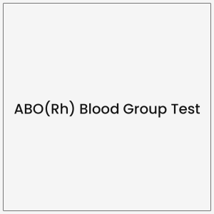 ABO(Rh) Blood Group Test