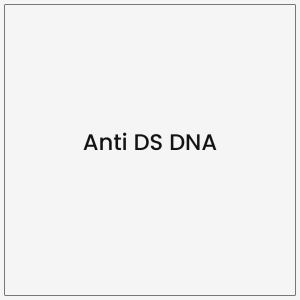 Anti DS DNA