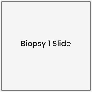 Biopsy 1 Slide