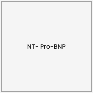 NT Pro BNP