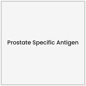 Prostate Specific Antigen