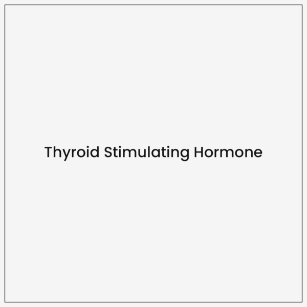 Thyroid Stimulating Hormone