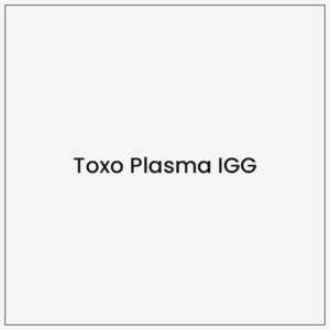 Toxo Plasma IGG