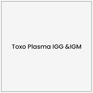 Toxo Plasma IGG & IGM