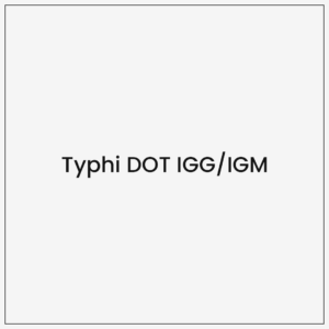 Typhi DOT IGG/IGM