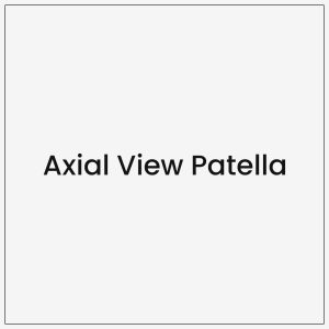Axial View Patella
