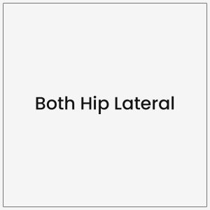 Both Hip Lateral