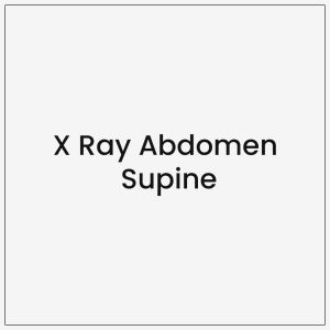 X Ray Abdomen Supine