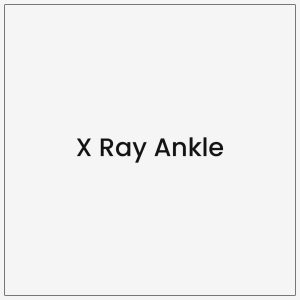X Ray Ankle