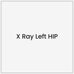 X Ray Left HIP