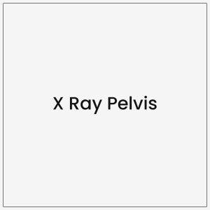 X Ray Pelvis