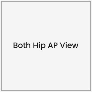 Both Hip AP View