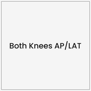 Both Knees AP/LAT