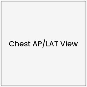 Chest AP/LAT View