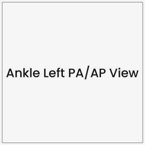 Ankle Left PA/AP View