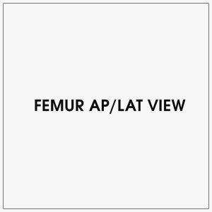 Femur AP/LAT View