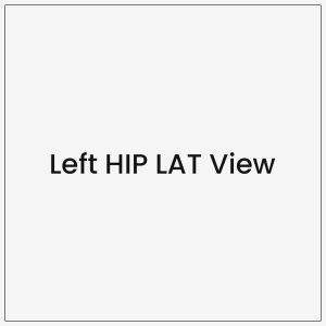 Left HIP LAT View
