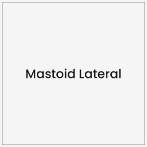 Mastoid Lateral