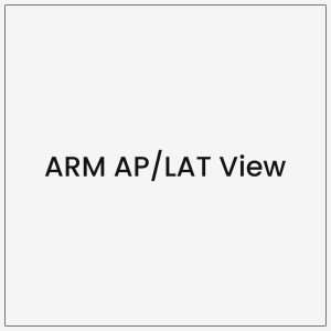 ARM AP/LAT View