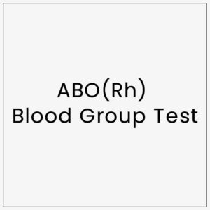 ABO(Rh) Blood Group Test