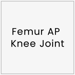 Femur AP Knee Joint